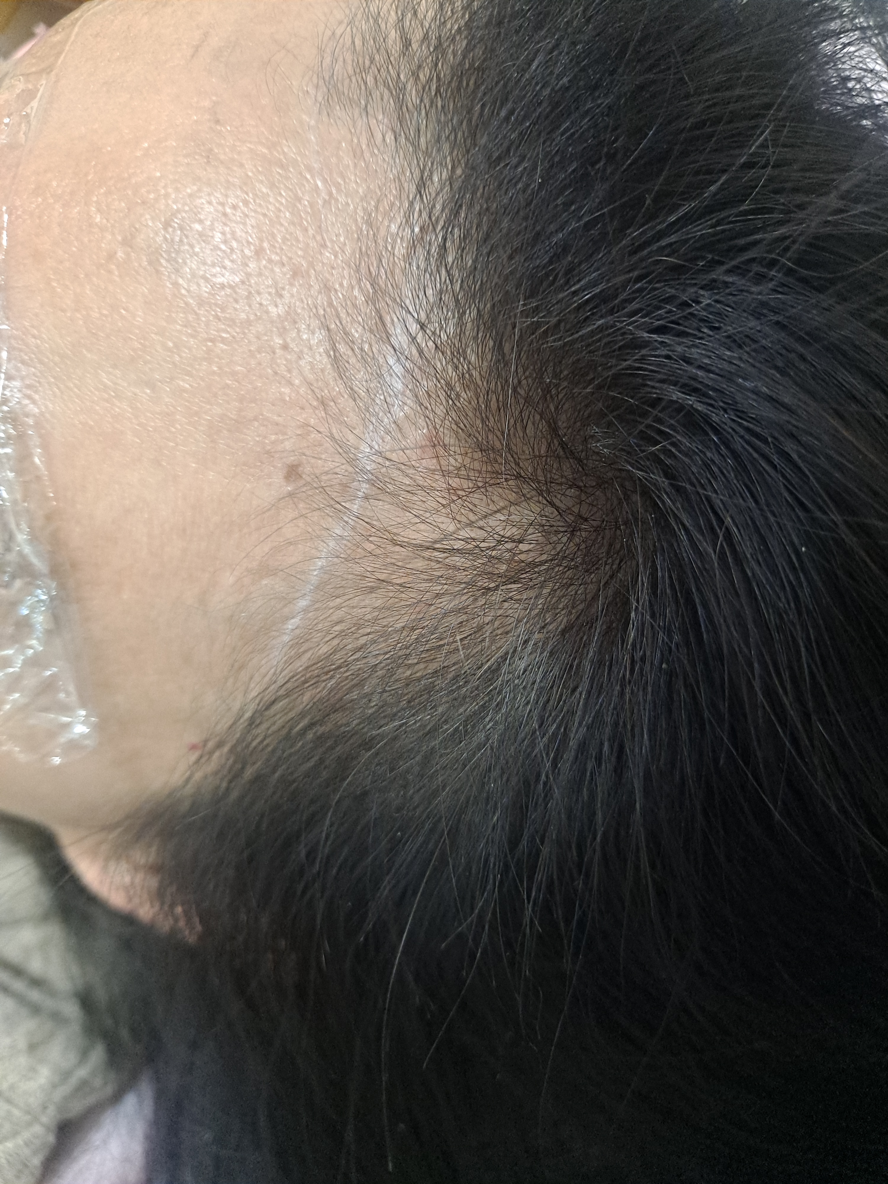 블랙핑고 대표 이미지