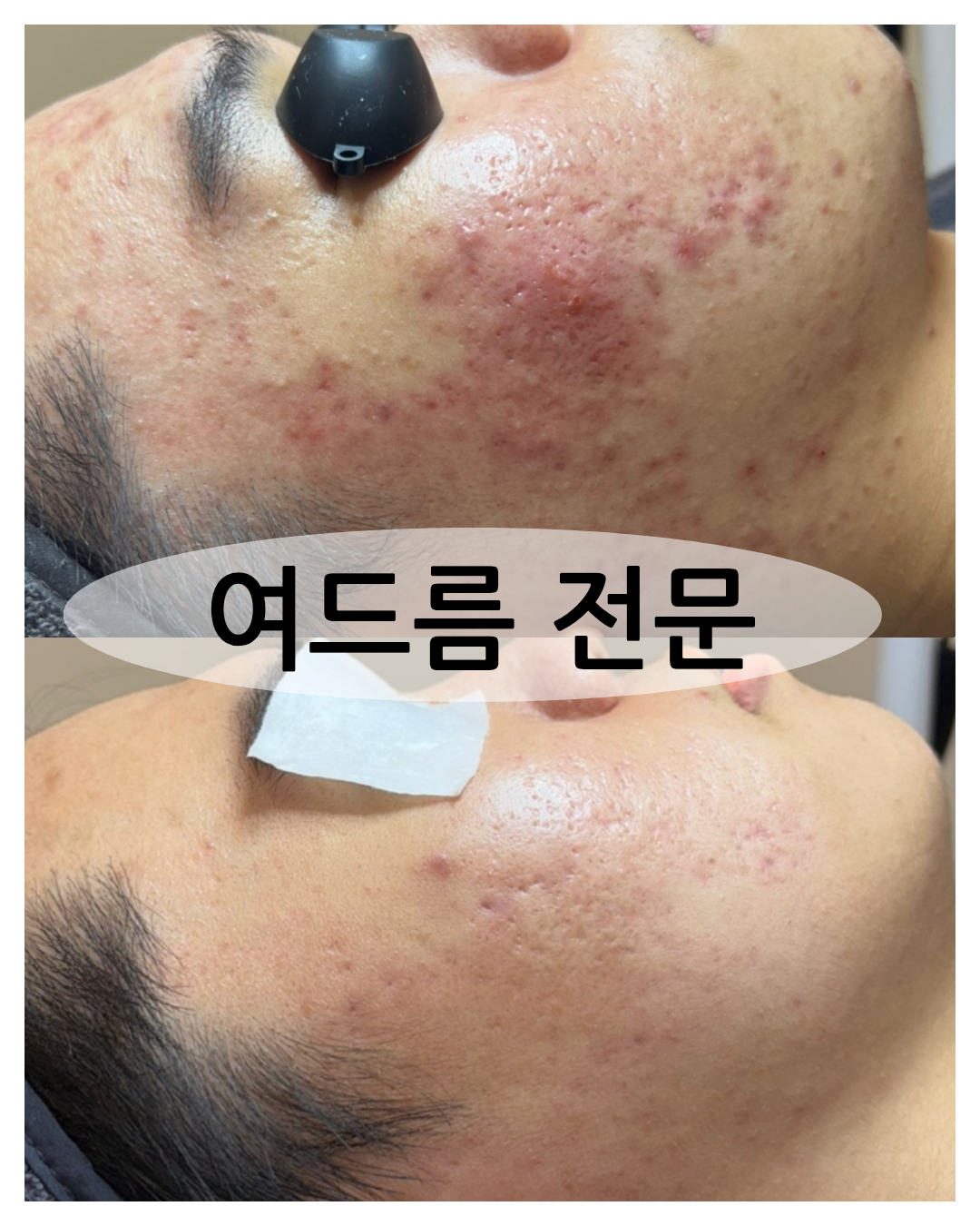 스킨담다 청라점 대표 이미지