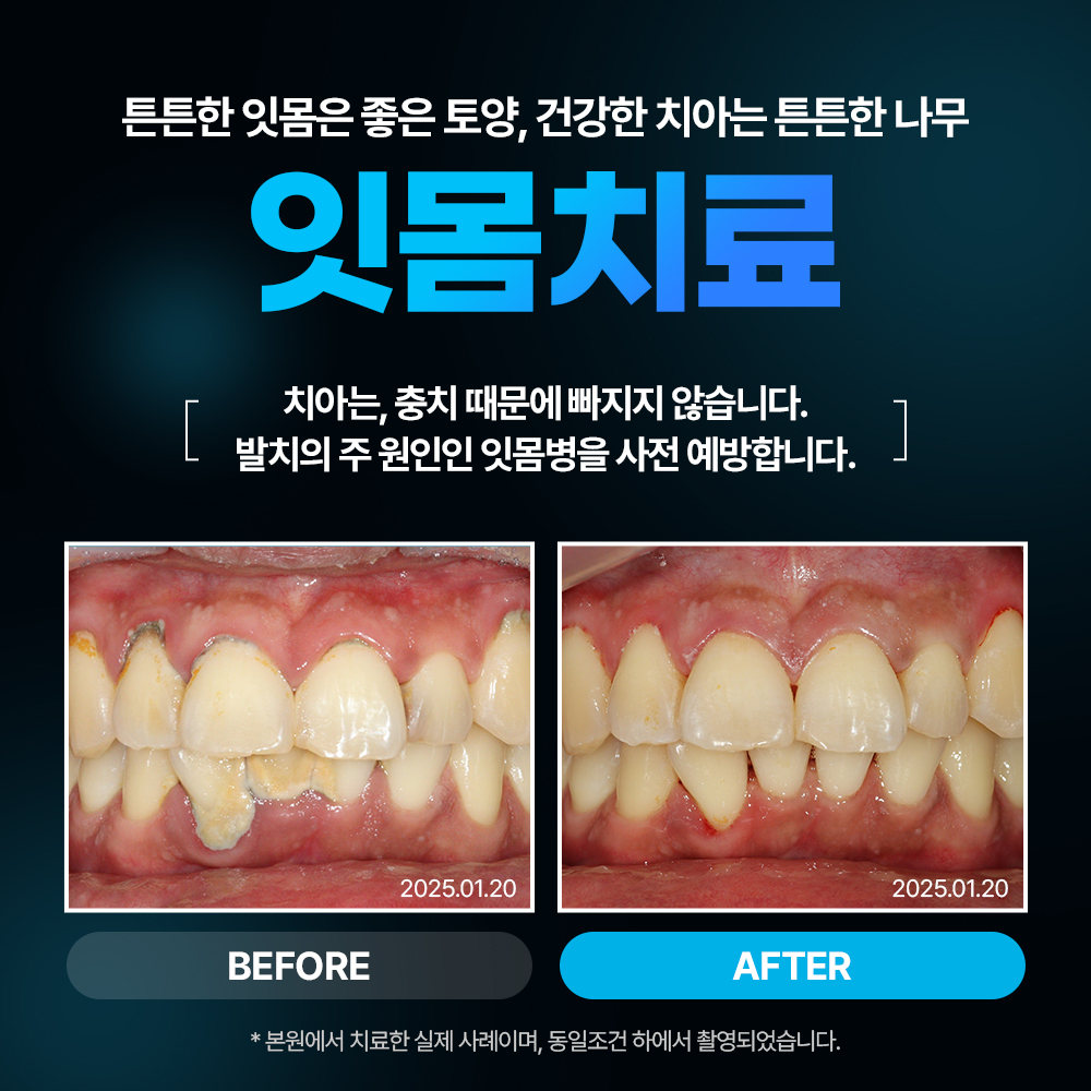 서울으뜸치과의원 수원 대표 이미지