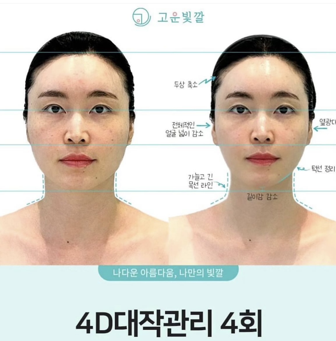 고운빛깔에스테틱 부산센텀점