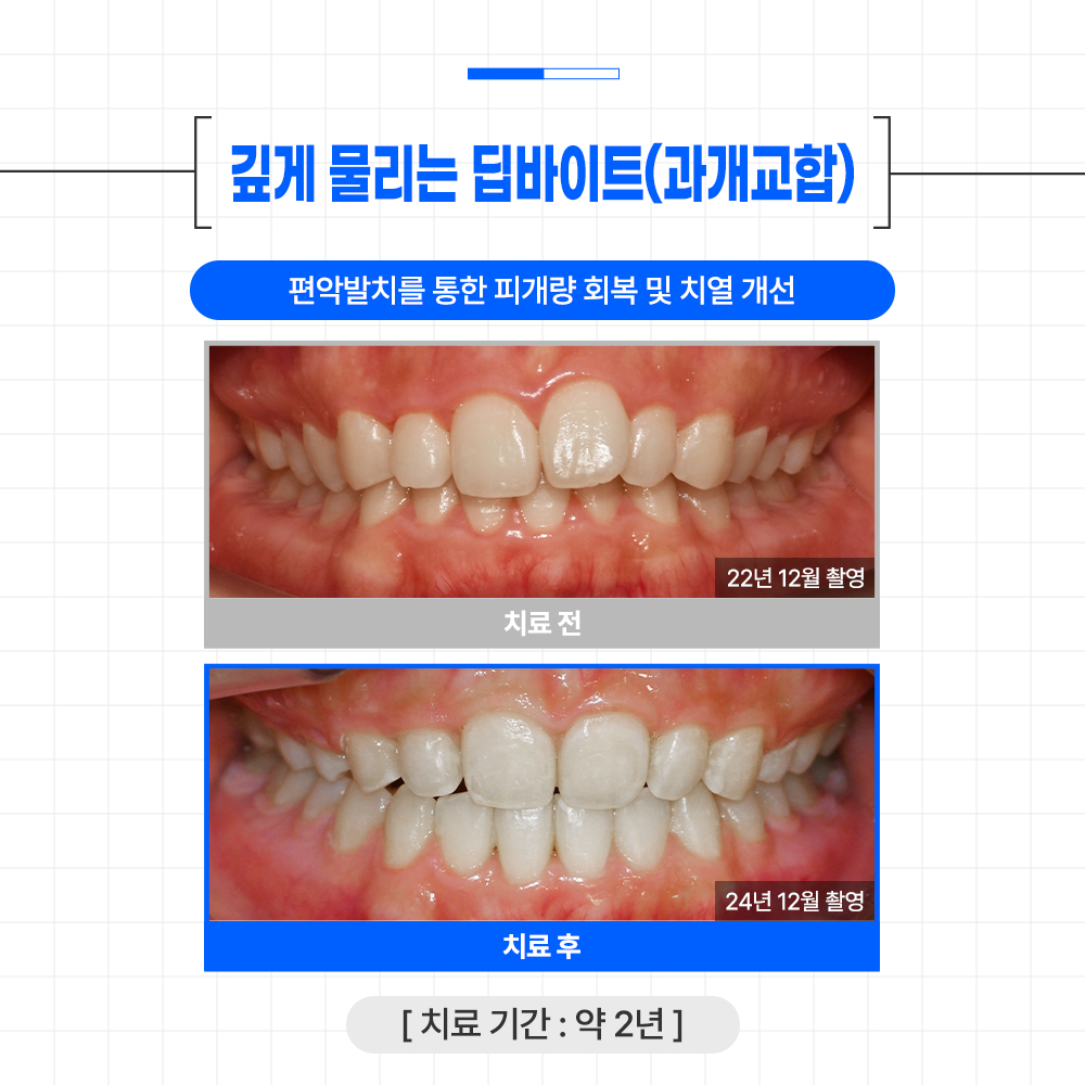 글로리치과교정과치과의원 대표 이미지