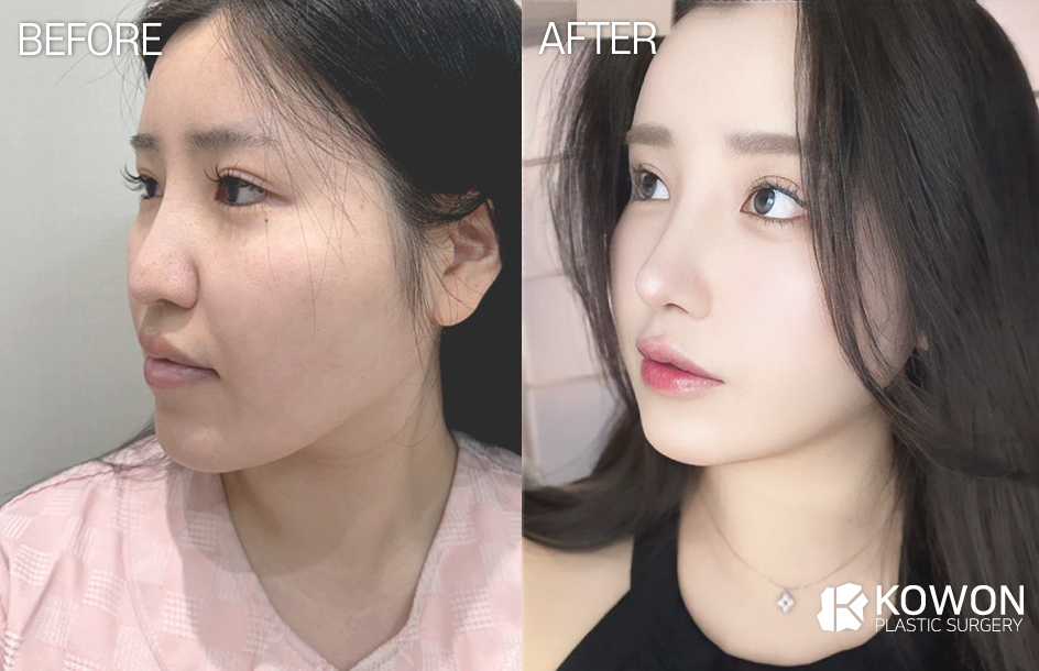 코원성형외과의원 대표 이미지