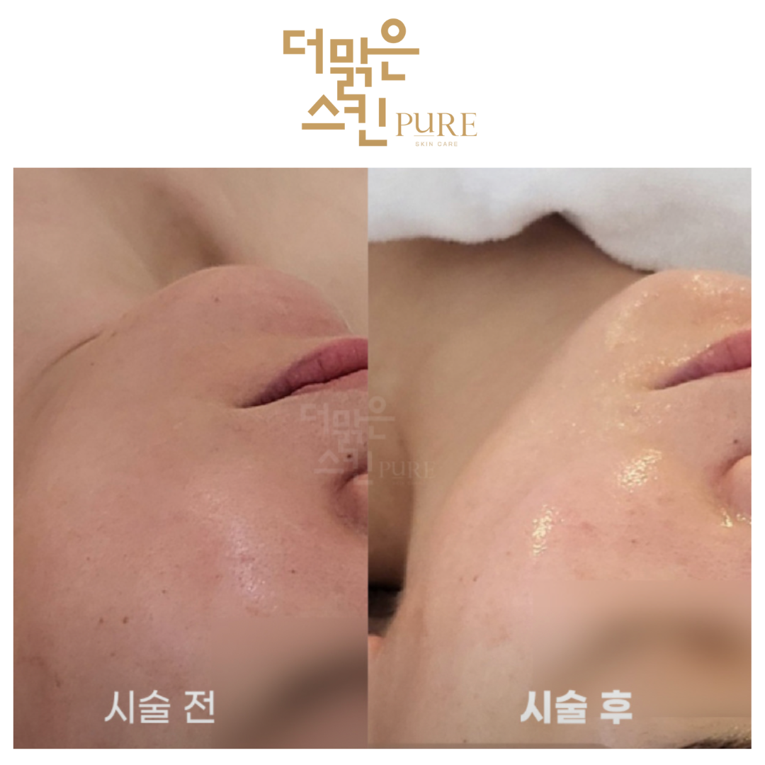 더맑은스킨 천안성성호수점