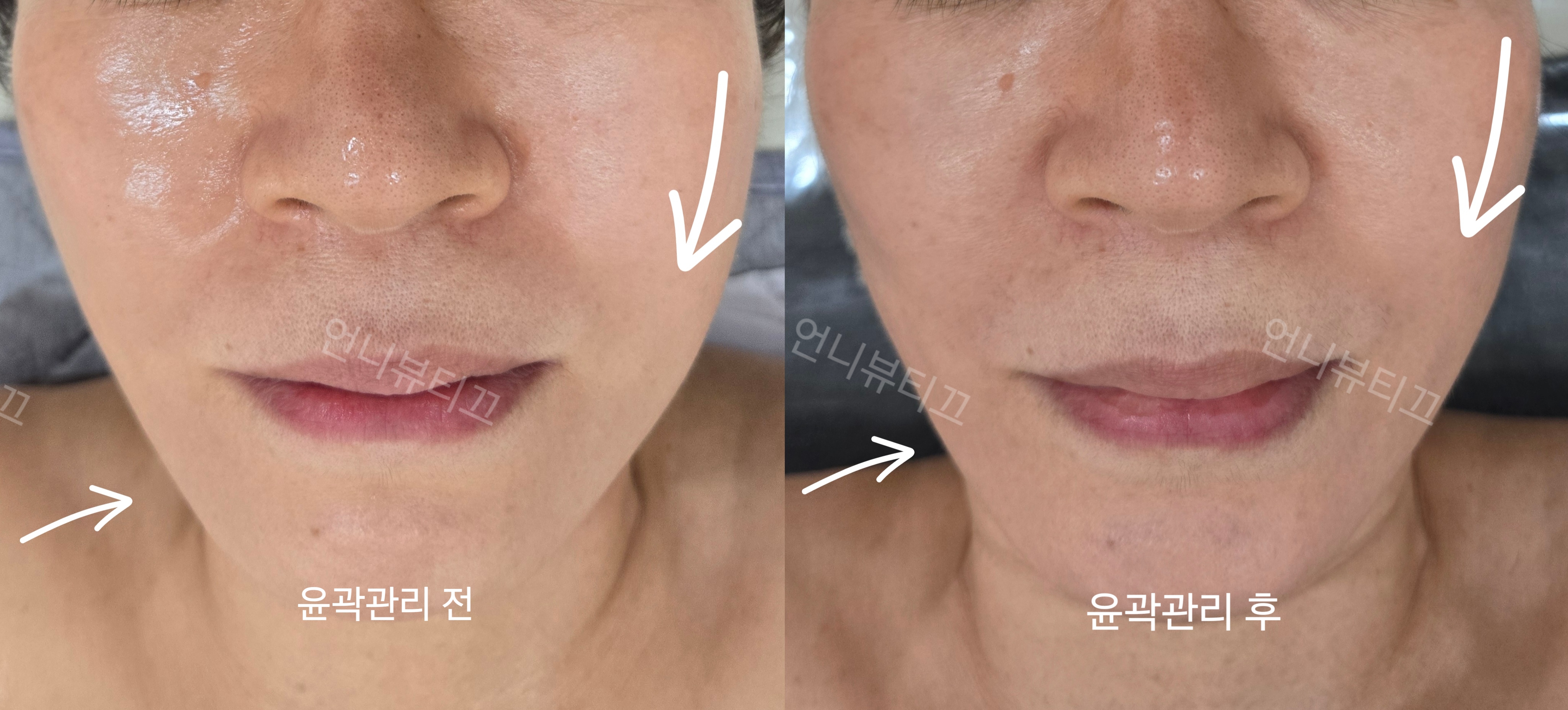 뷰티하리 김포장기점 photo 6