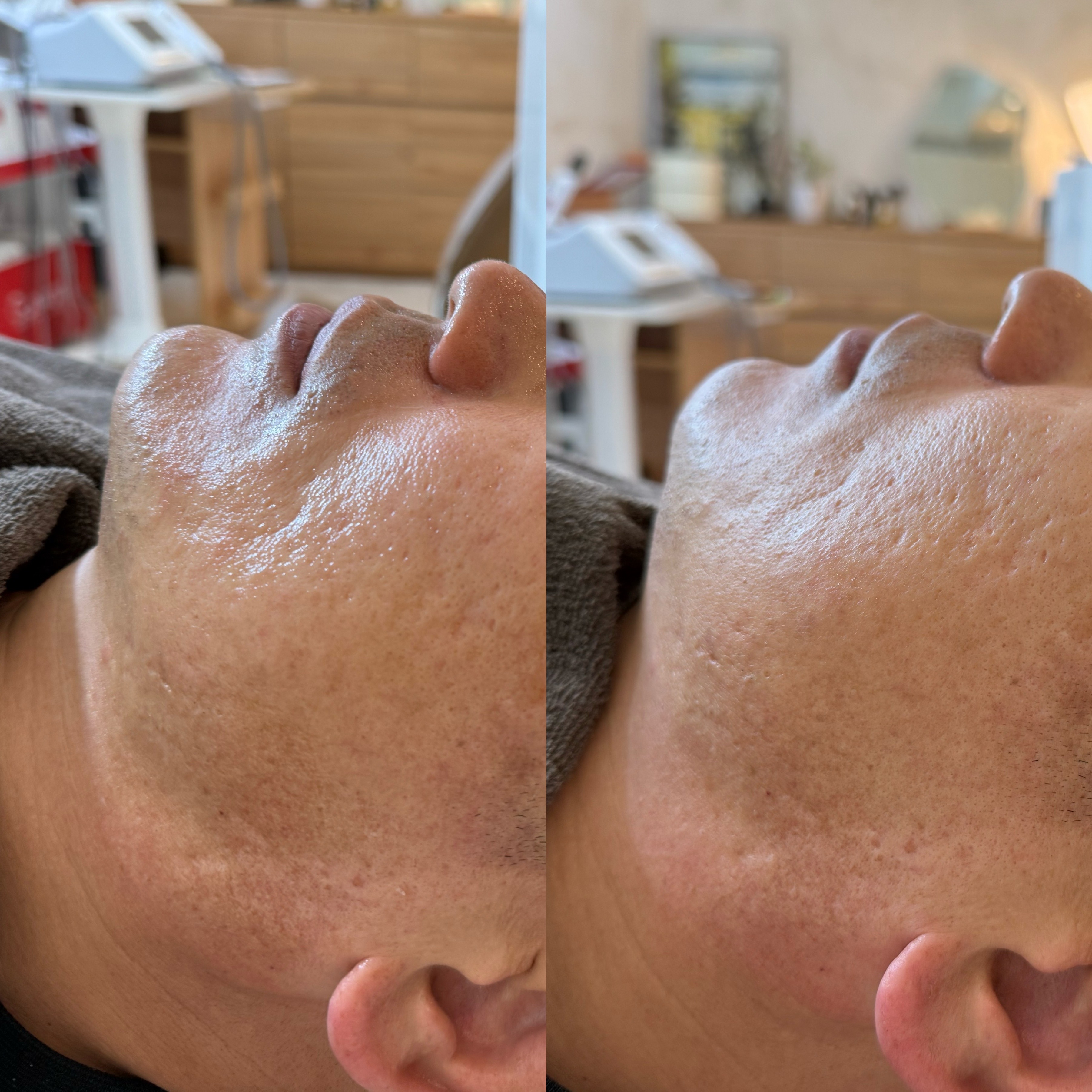 율하힐즈 대표 이미지