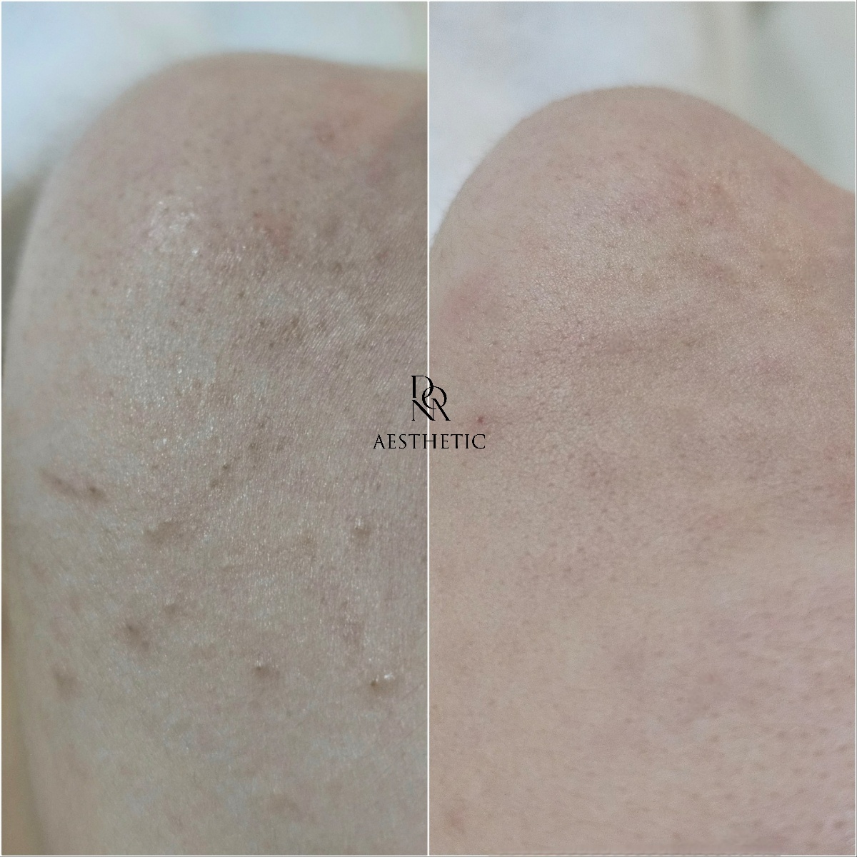 도나에스테틱 압구정 대표 이미지