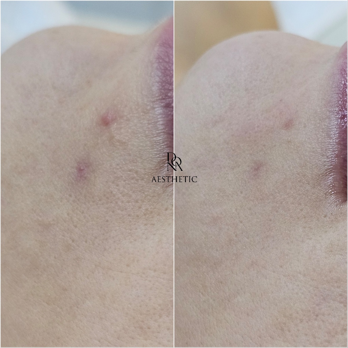 도나에스테틱 대표 이미지