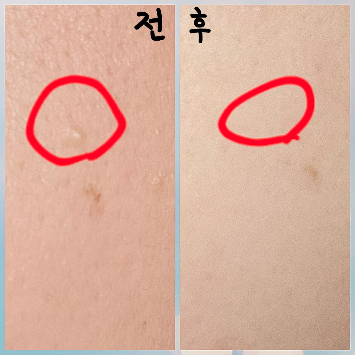 르네셀