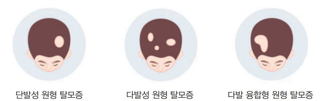 모리셋두피재생센터 창원점 대표 이미지