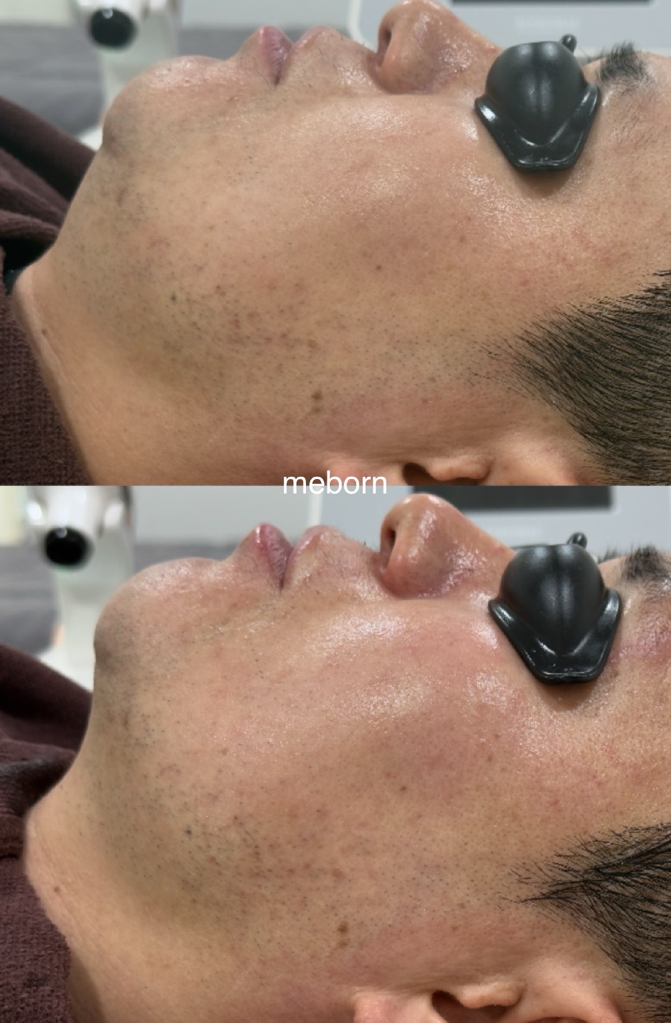 미본에스테틱 대표 이미지