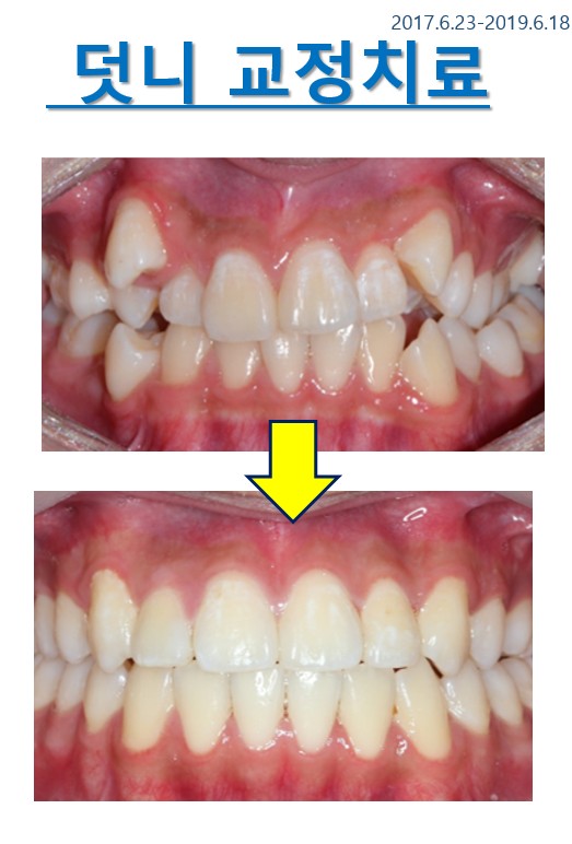 연세클리어치과교정과치과의원 대표 이미지