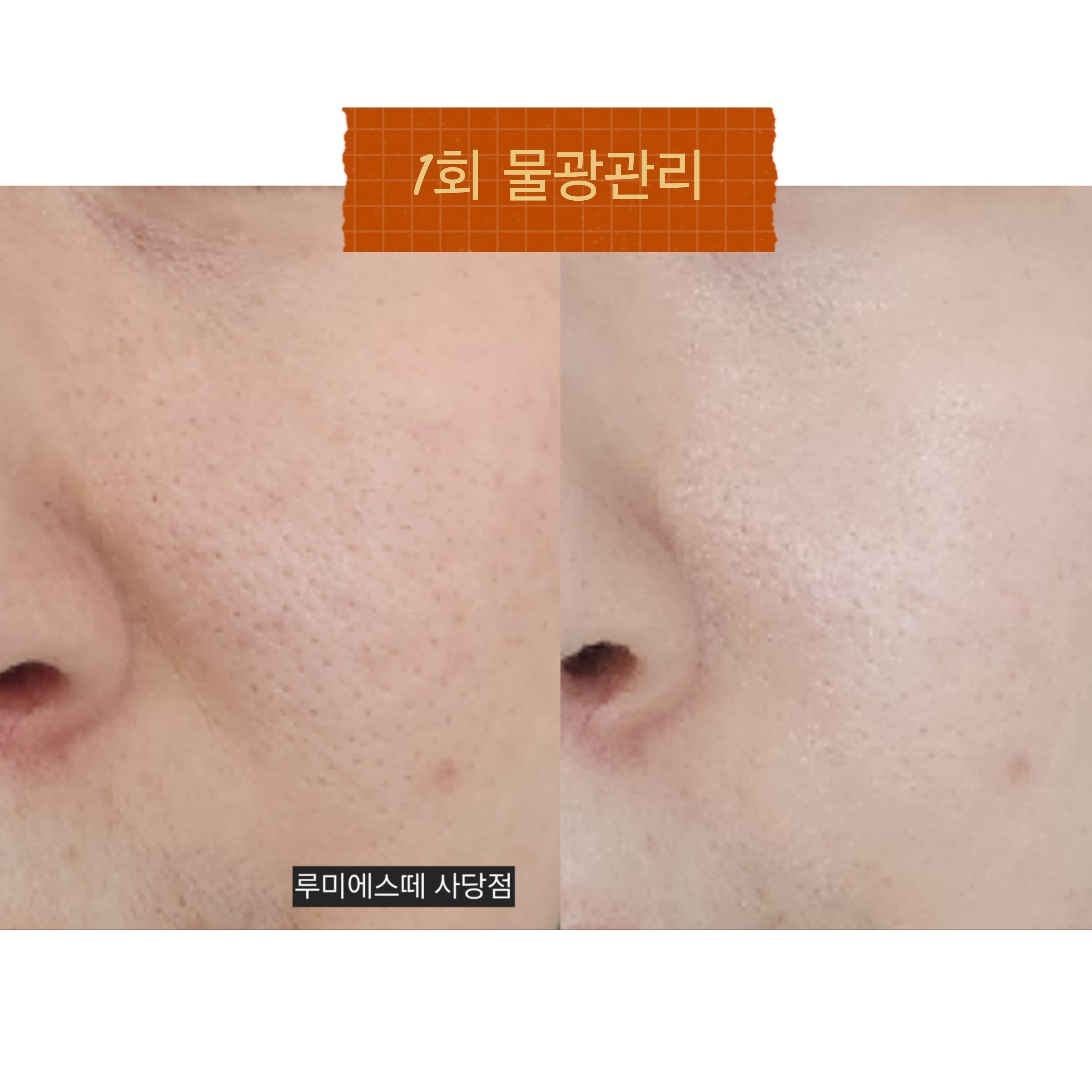 루미에스떼 사당점