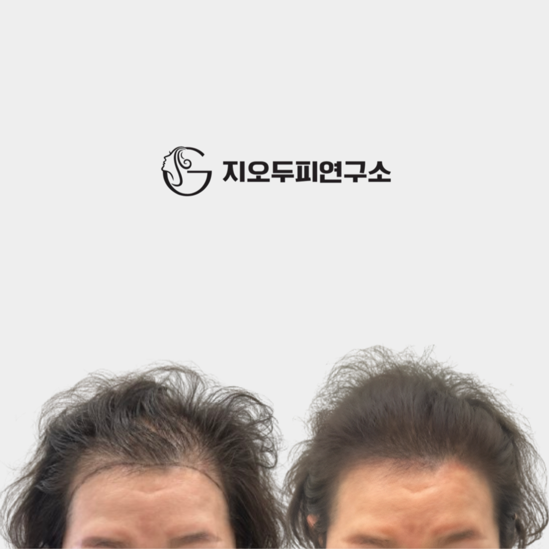 지오두피연구소