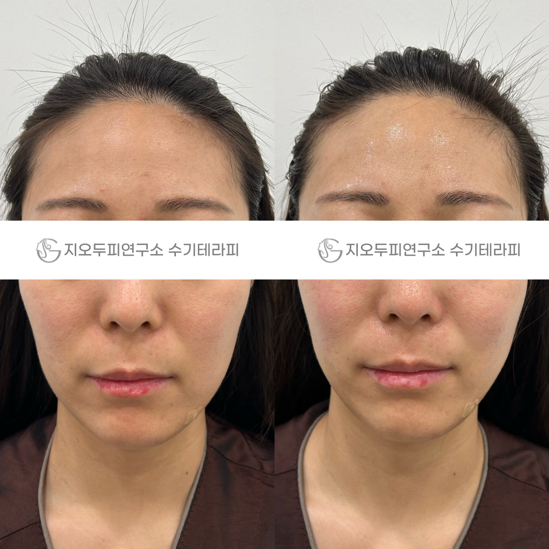 지오두피연구소