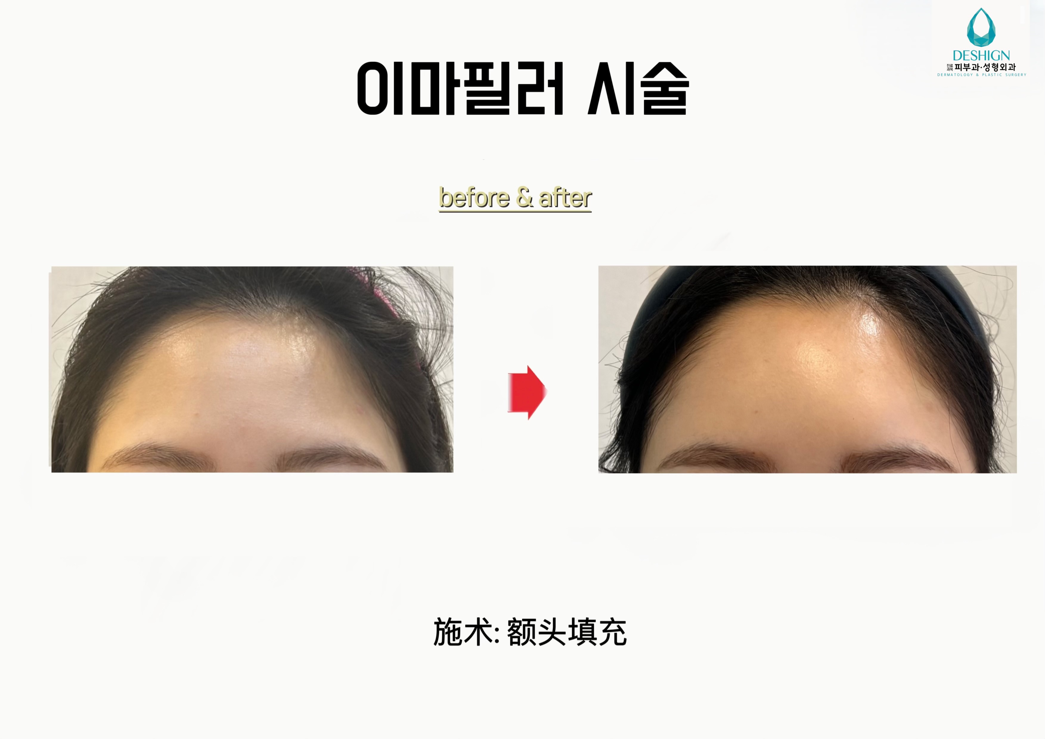 디샤인의원