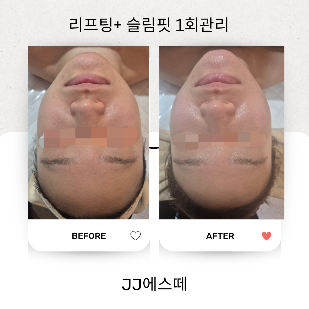 제이제이 에스떼 홍대점 대표 이미지