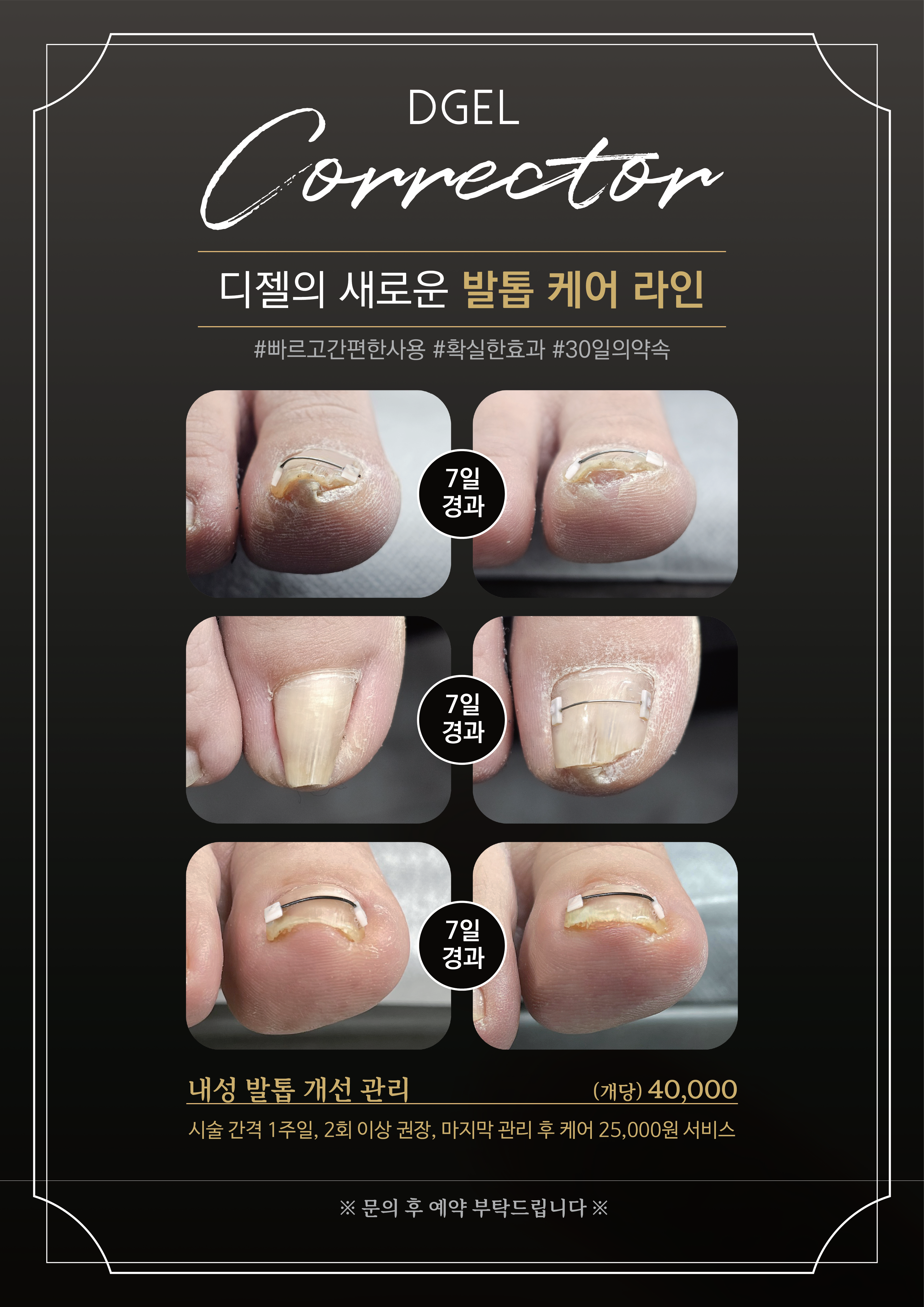 이쁘쥬네일