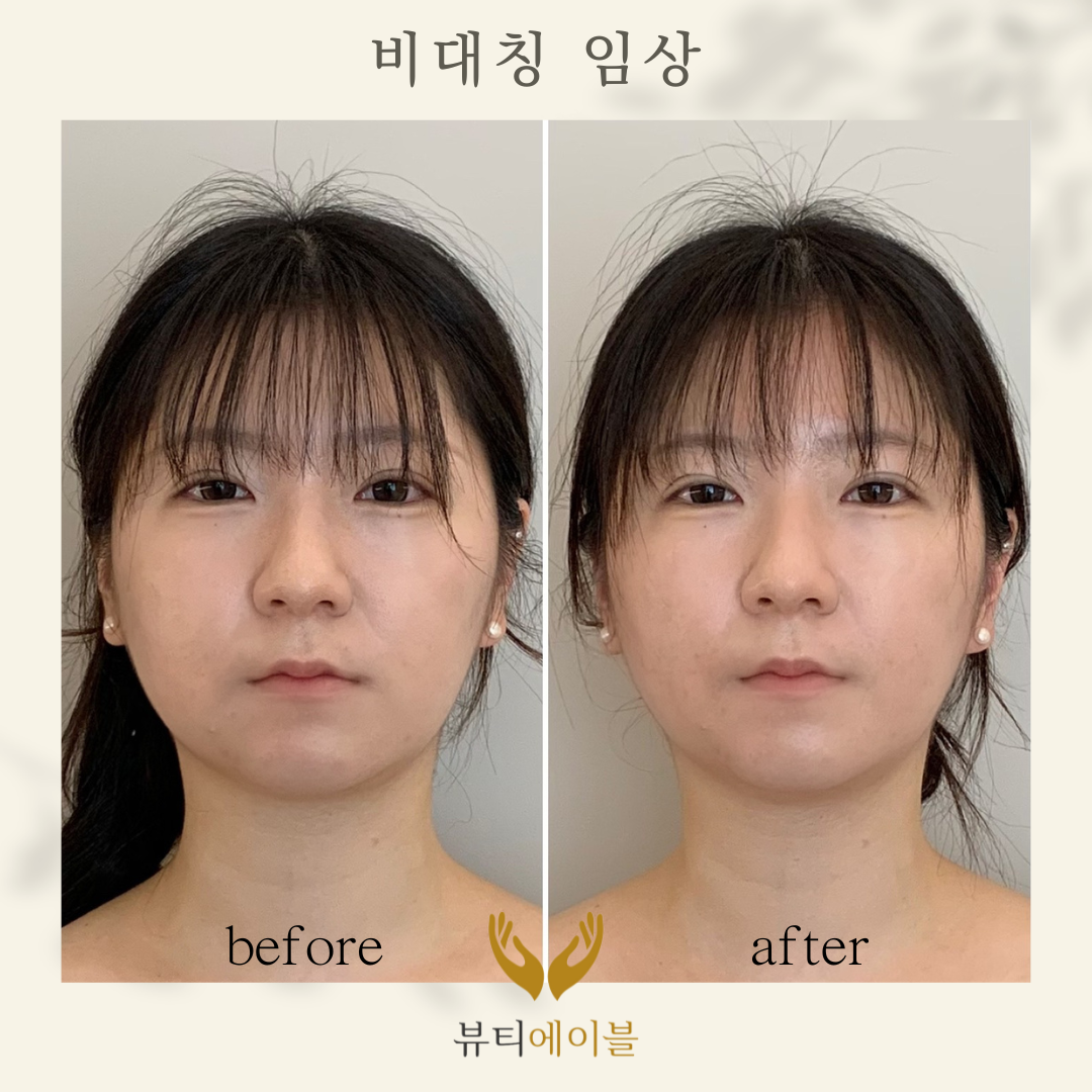 뷰티에이블 대표 이미지