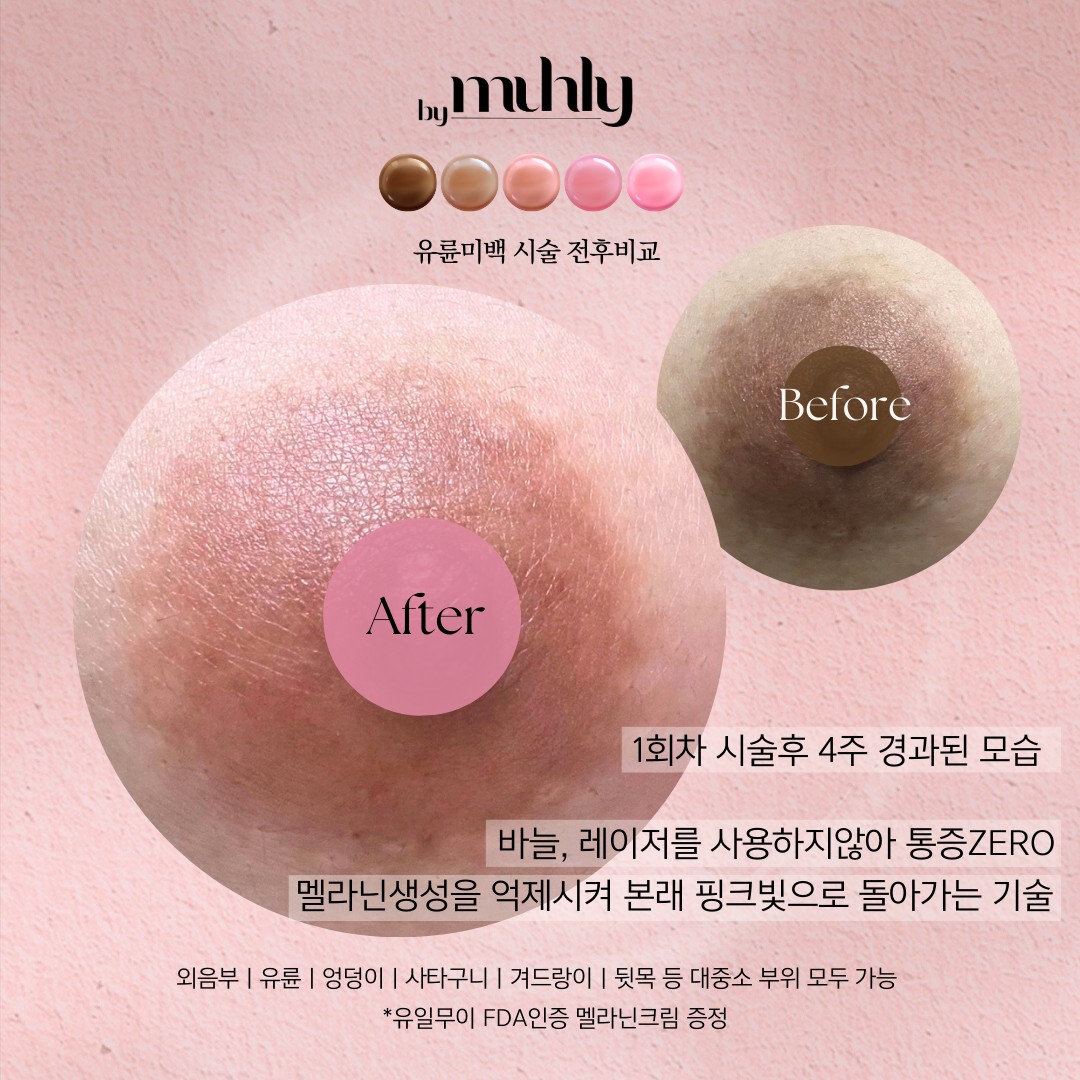 바이뮬리 송도 대표 이미지