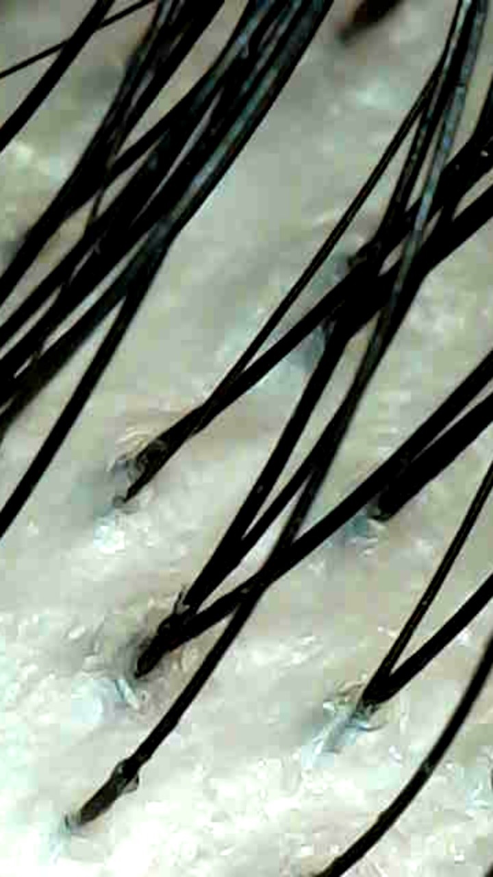 더조각 청주두피 대표 이미지