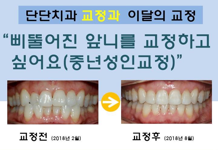 단단치과의원 대표 이미지