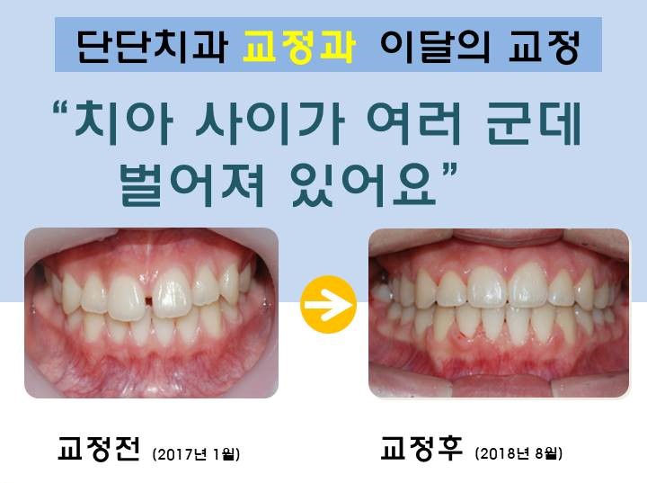 단단치과의원 대표 이미지