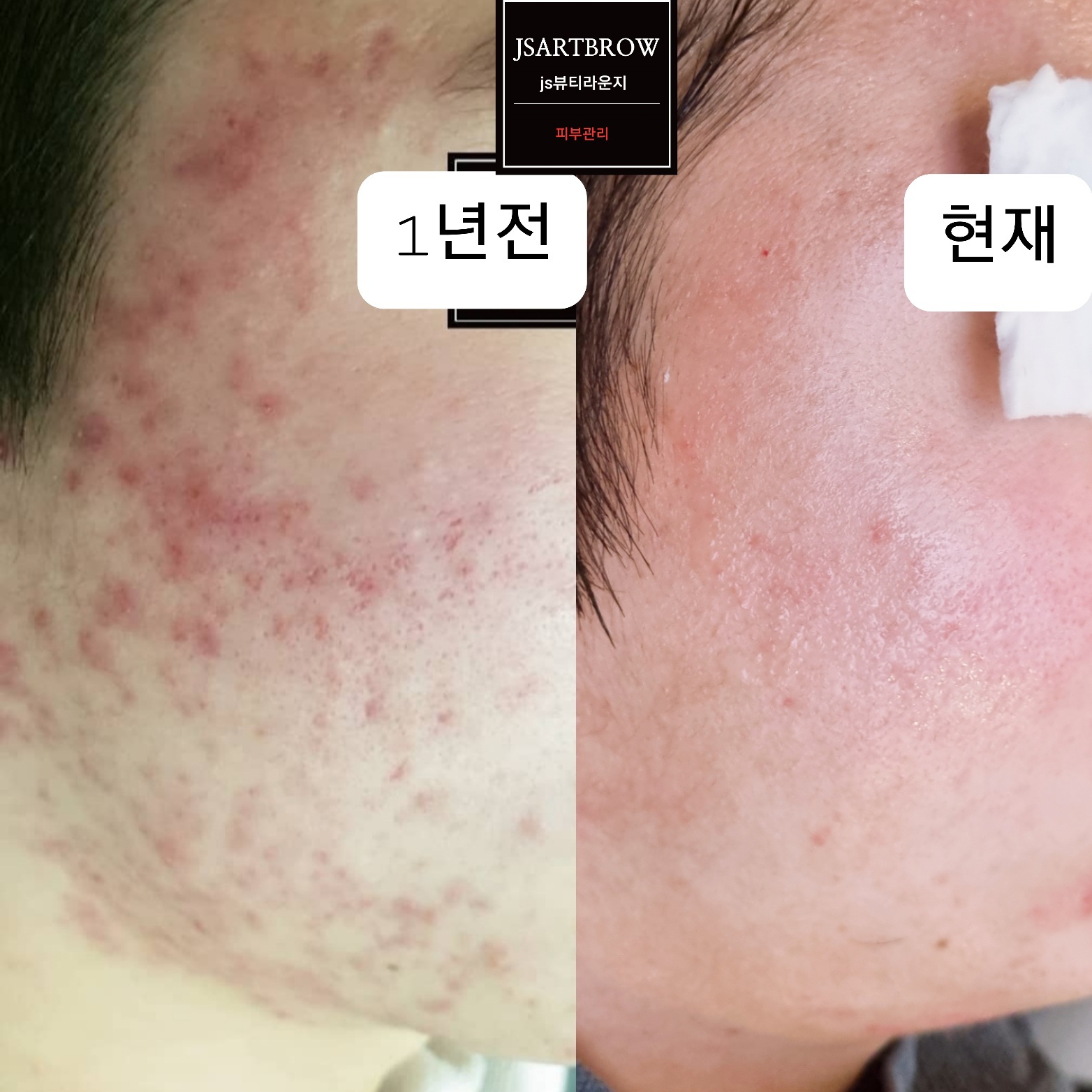 js메디스킨 대표 이미지