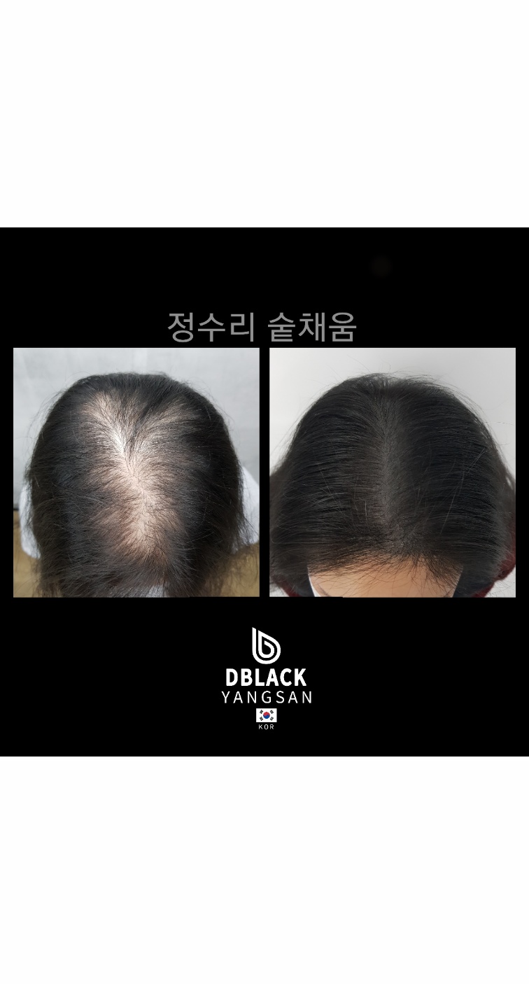 디블랙아카데미