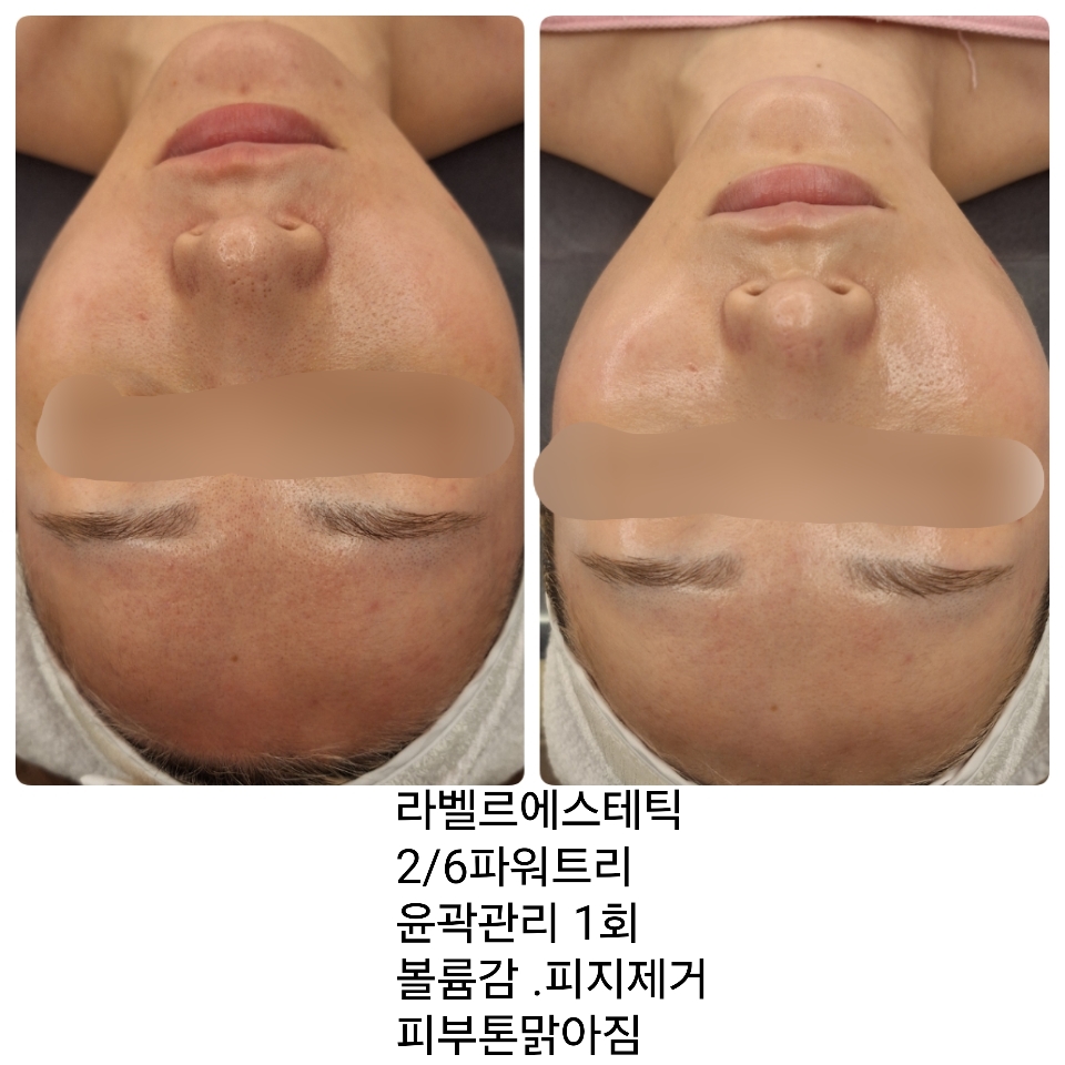 라벨르에스테틱