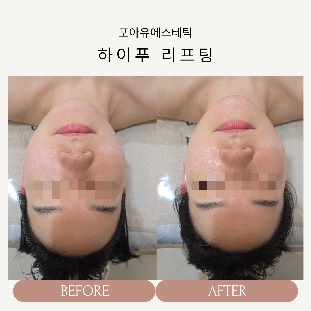 포아유에스테틱 대표 이미지