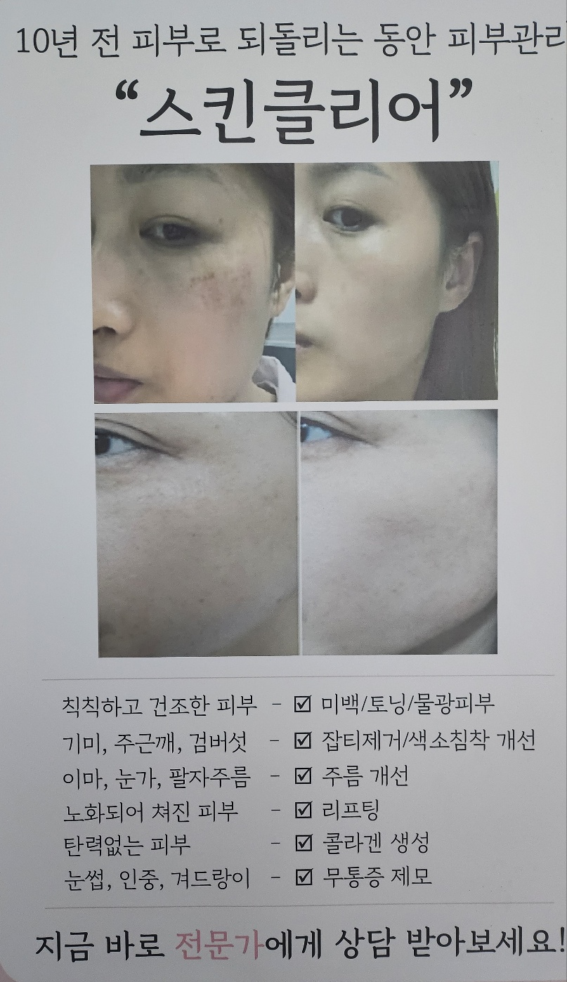 예쁘제스킨샵