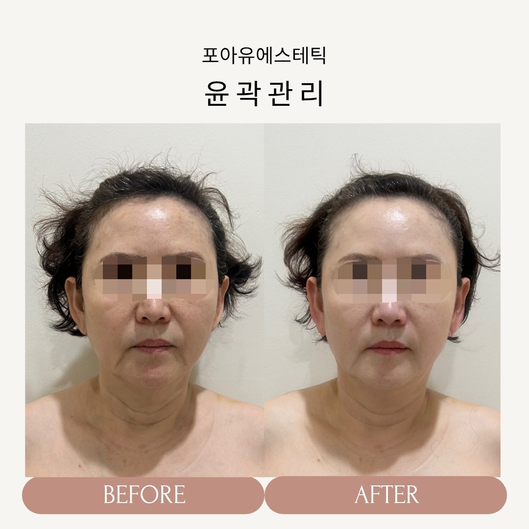 포아유에스테틱 대표 이미지