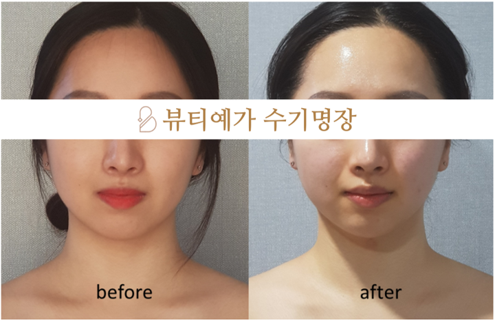 뷰티예가 수기명장 부산동래사직본점 photo 5