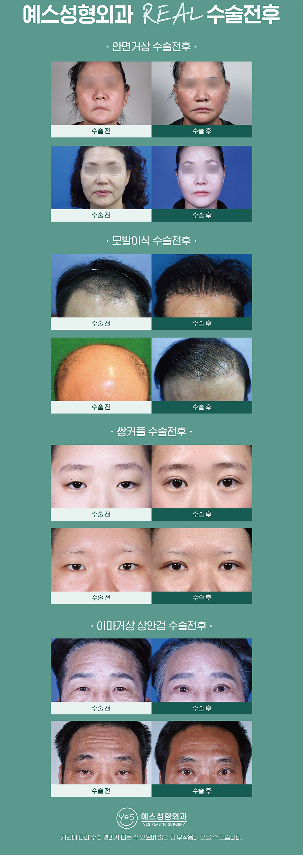 예스성형외과의원 대표 이미지