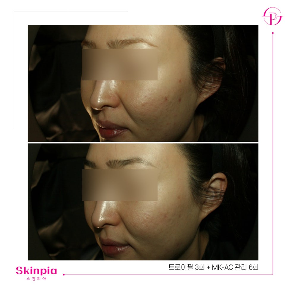 스킨피아 대표 이미지