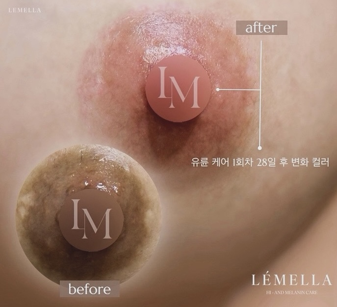 고운아이뷰티