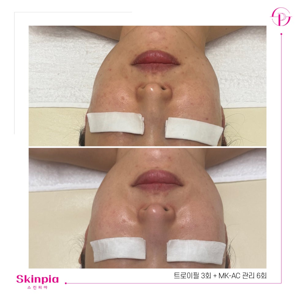 스킨피아 대표 이미지