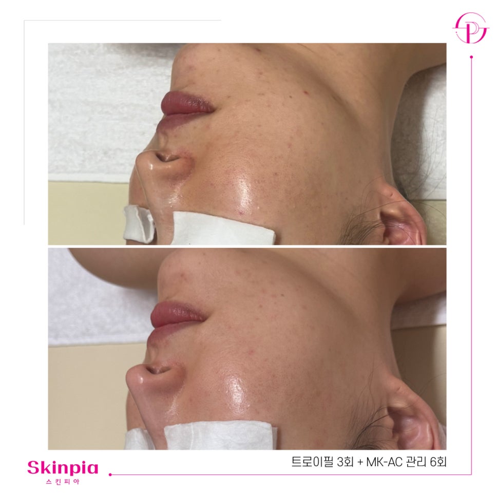 스킨피아 대표 이미지