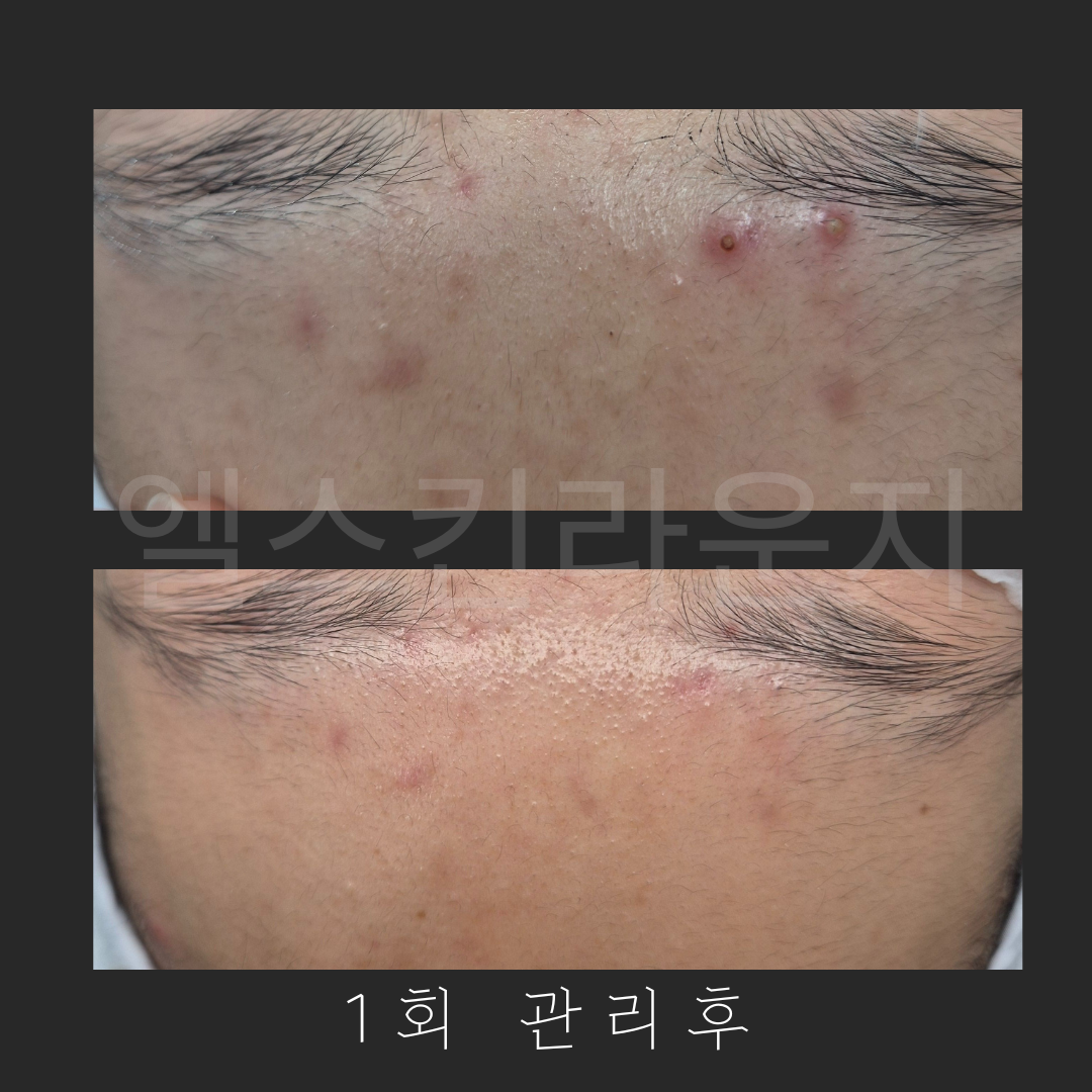 엘스킨라운지 대표 이미지