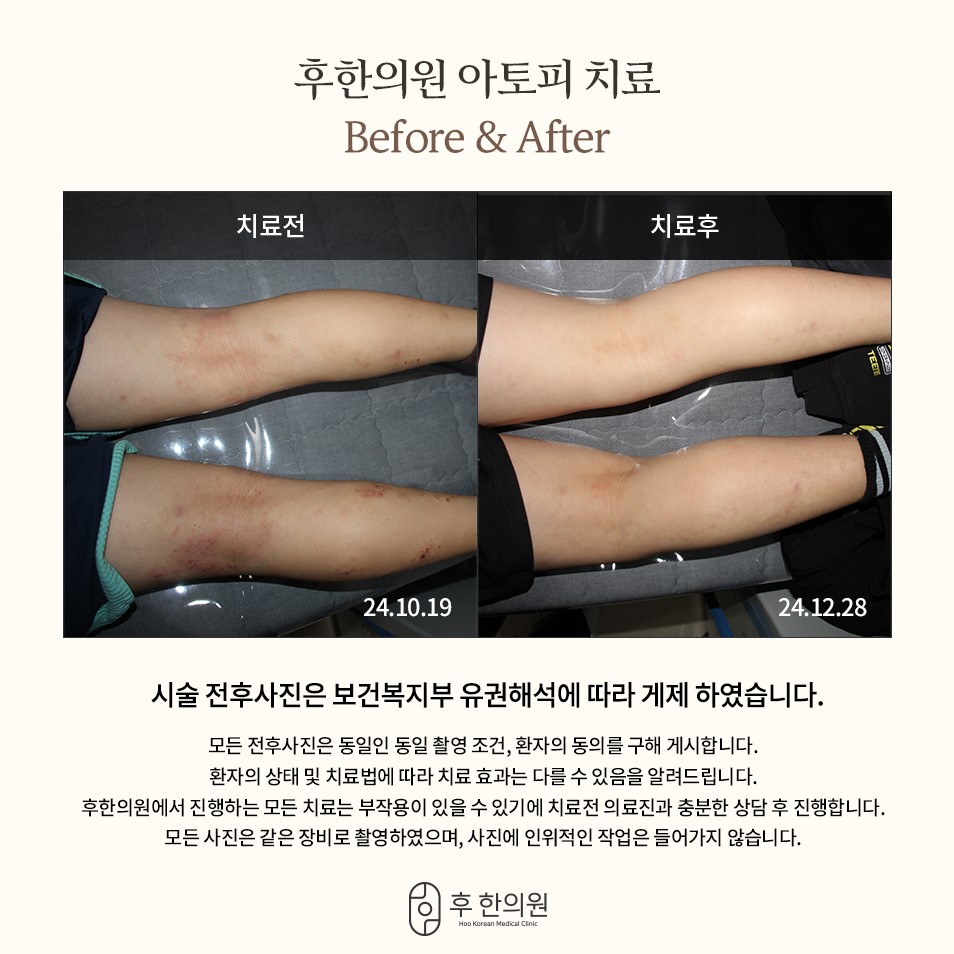 후한의원 춘천 대표 이미지