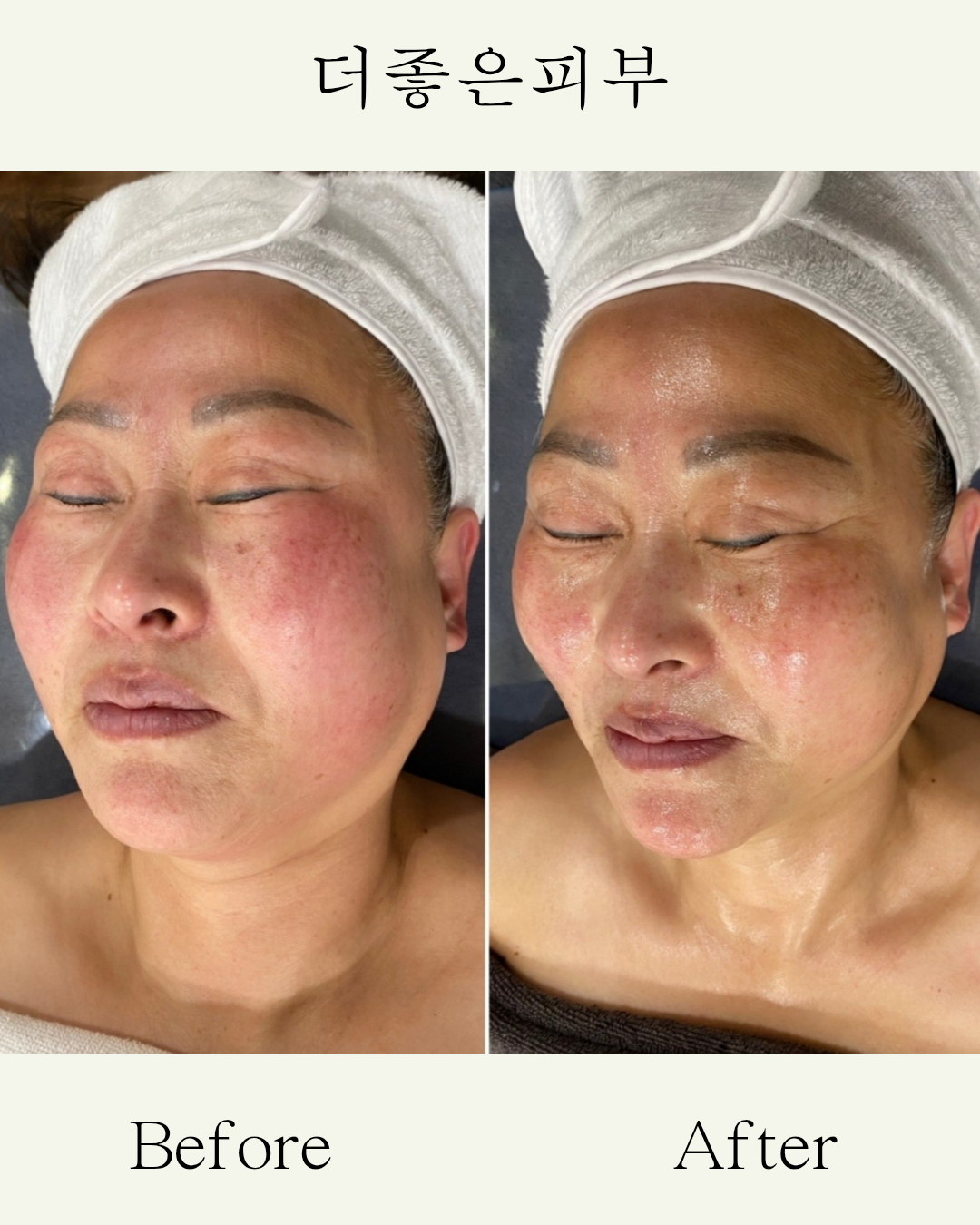더좋은피부