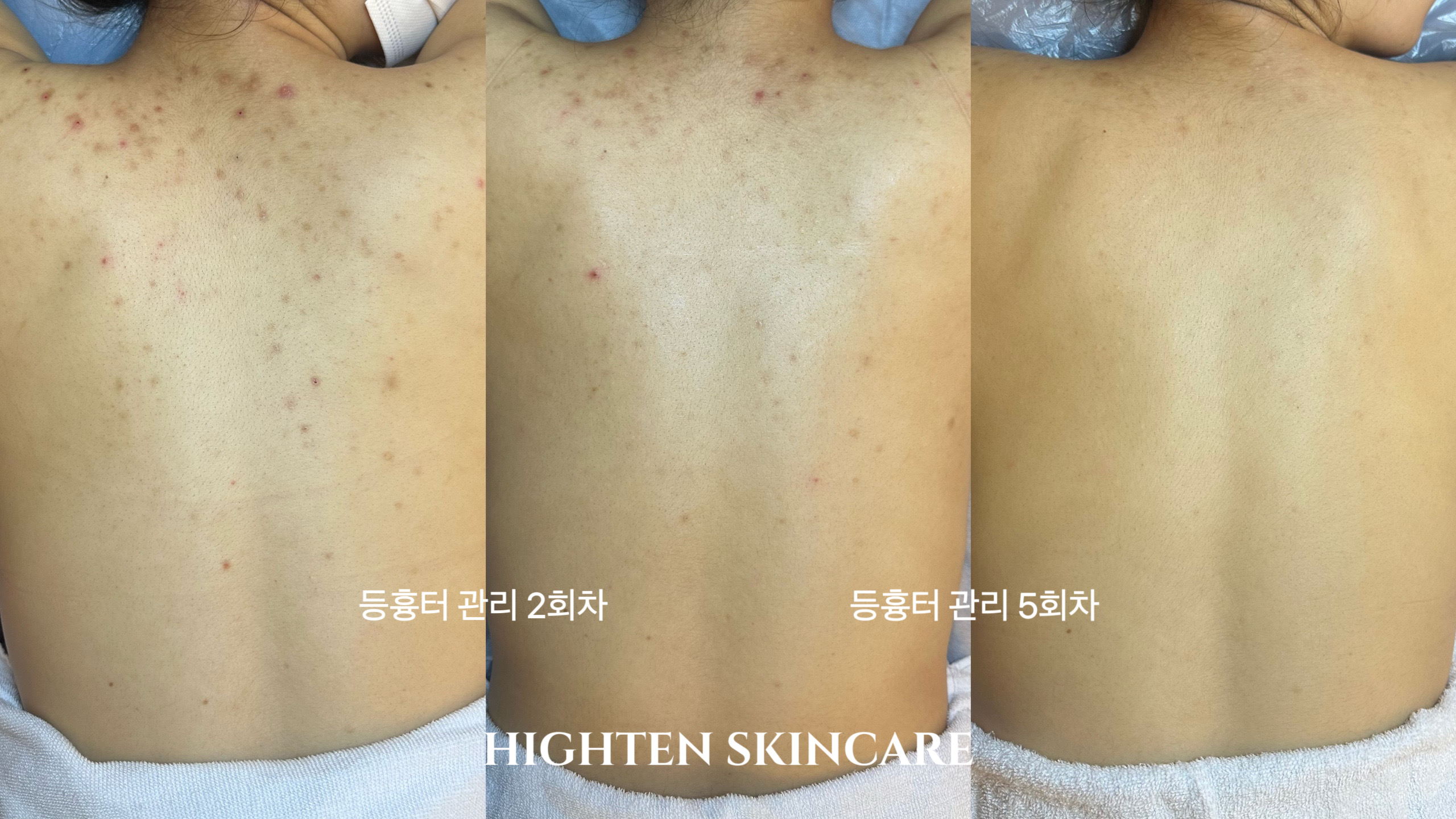 하이텐에스테틱 대표 이미지
