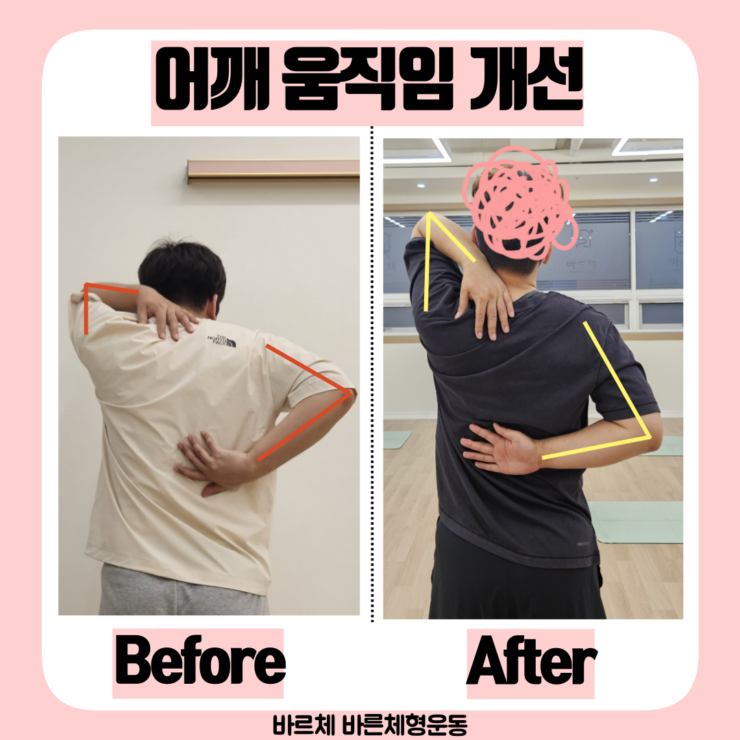 바르체 바른체형운동 대표 이미지