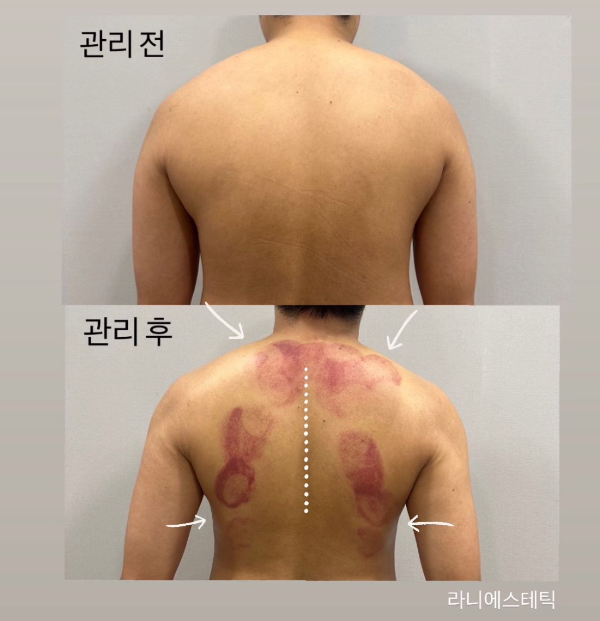라니에스테틱 대표 이미지