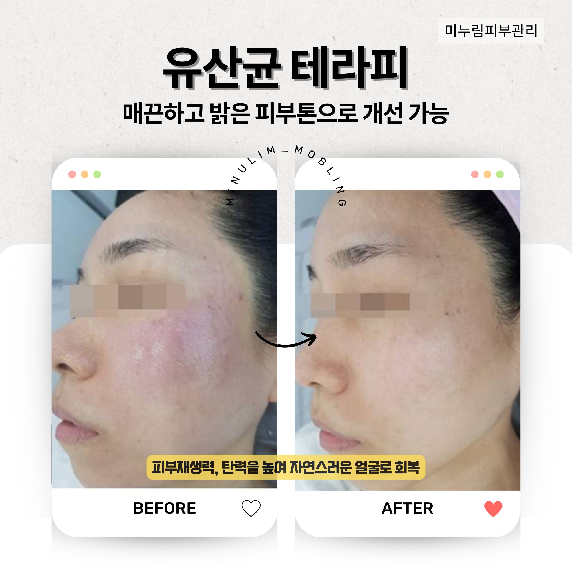 모블링스킨앤바디왁싱