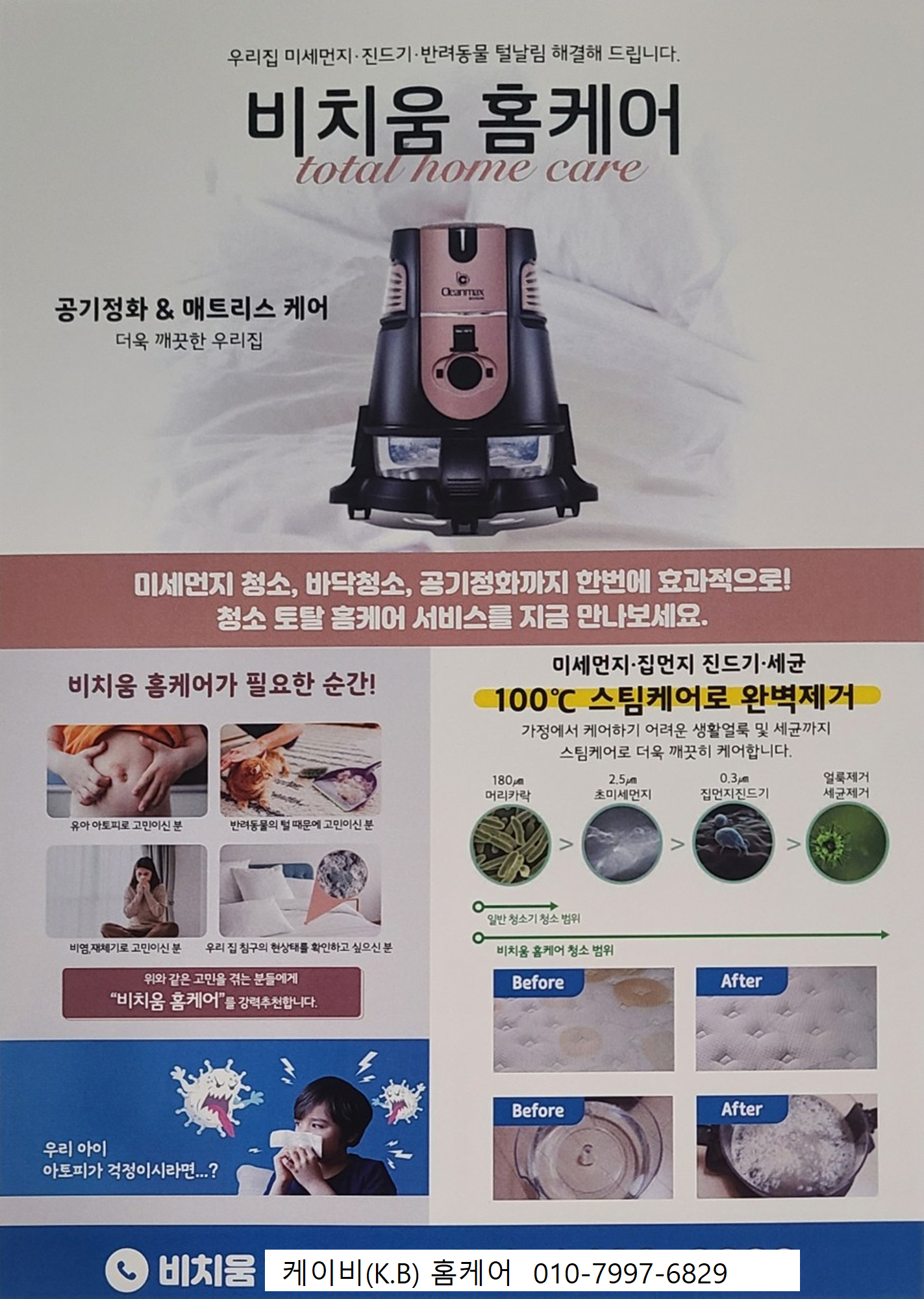 비치움케이비홈케어