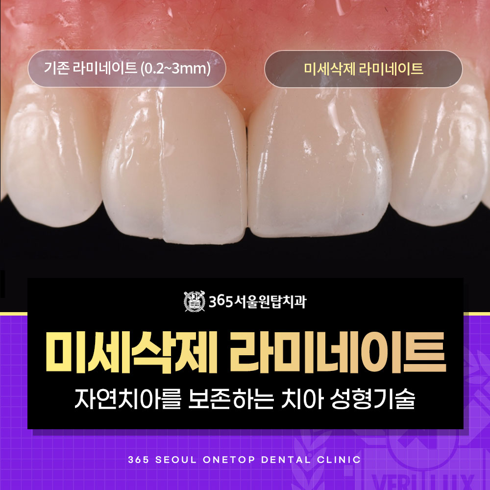 365서울원탑치과의원