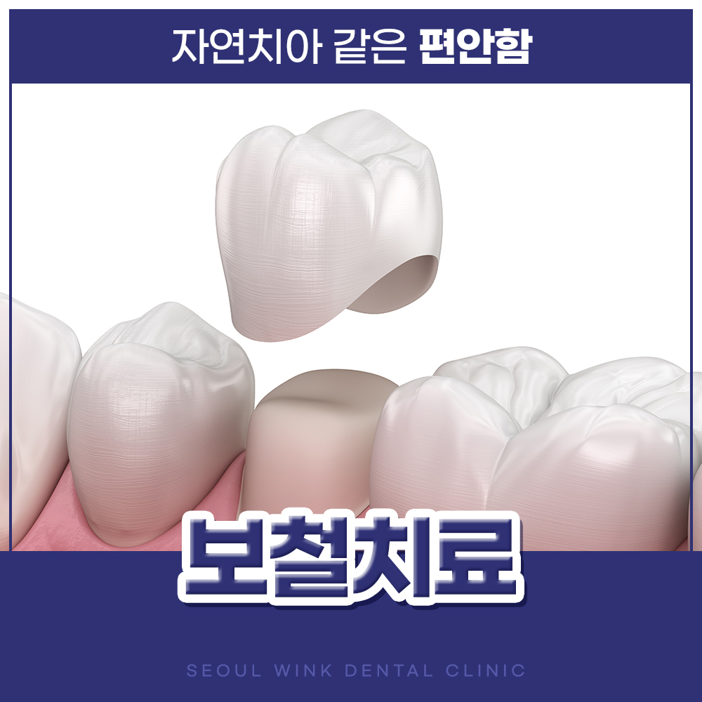 서울윙크치과의원 대표 이미지