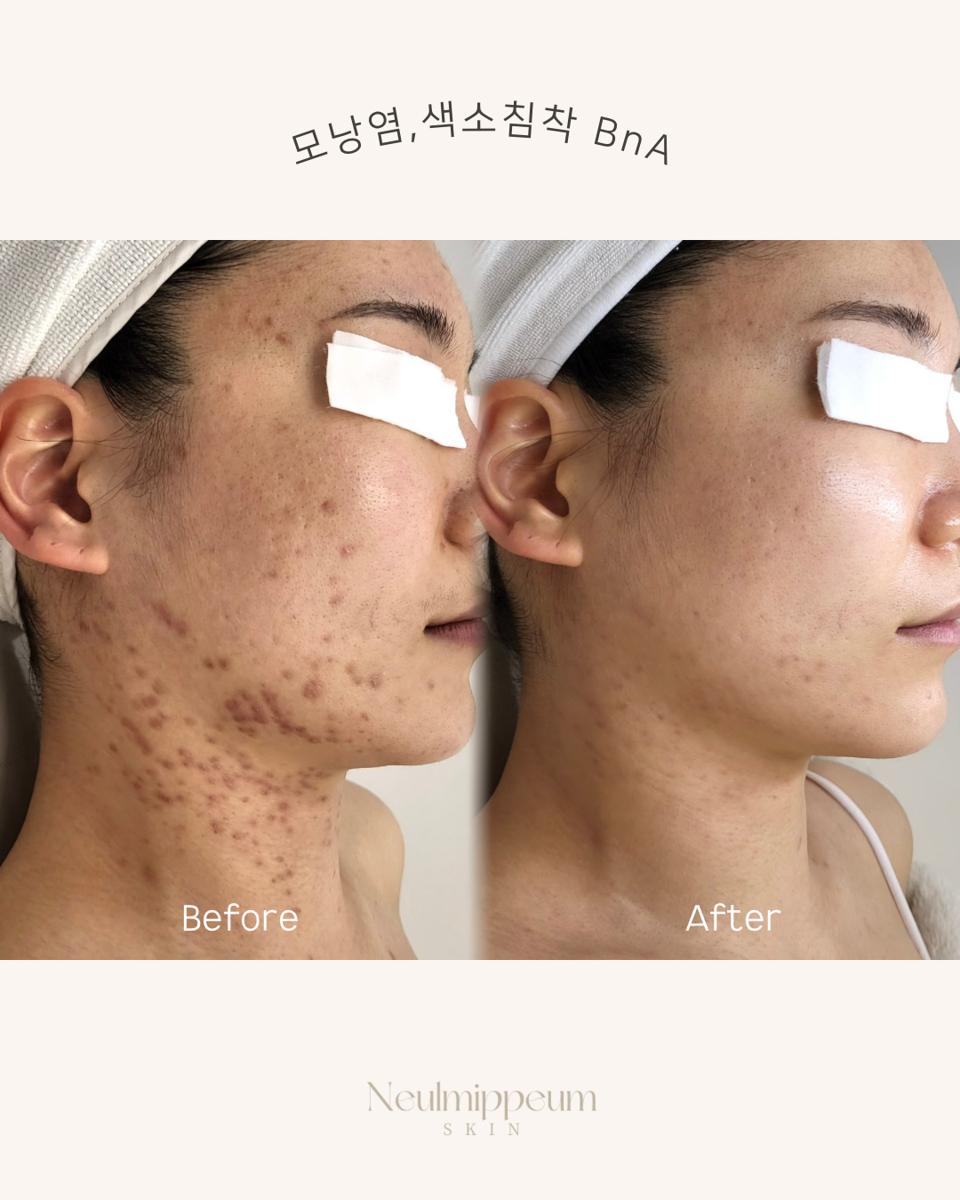 늘미쁨스킨 평택고덕본점 대표 이미지