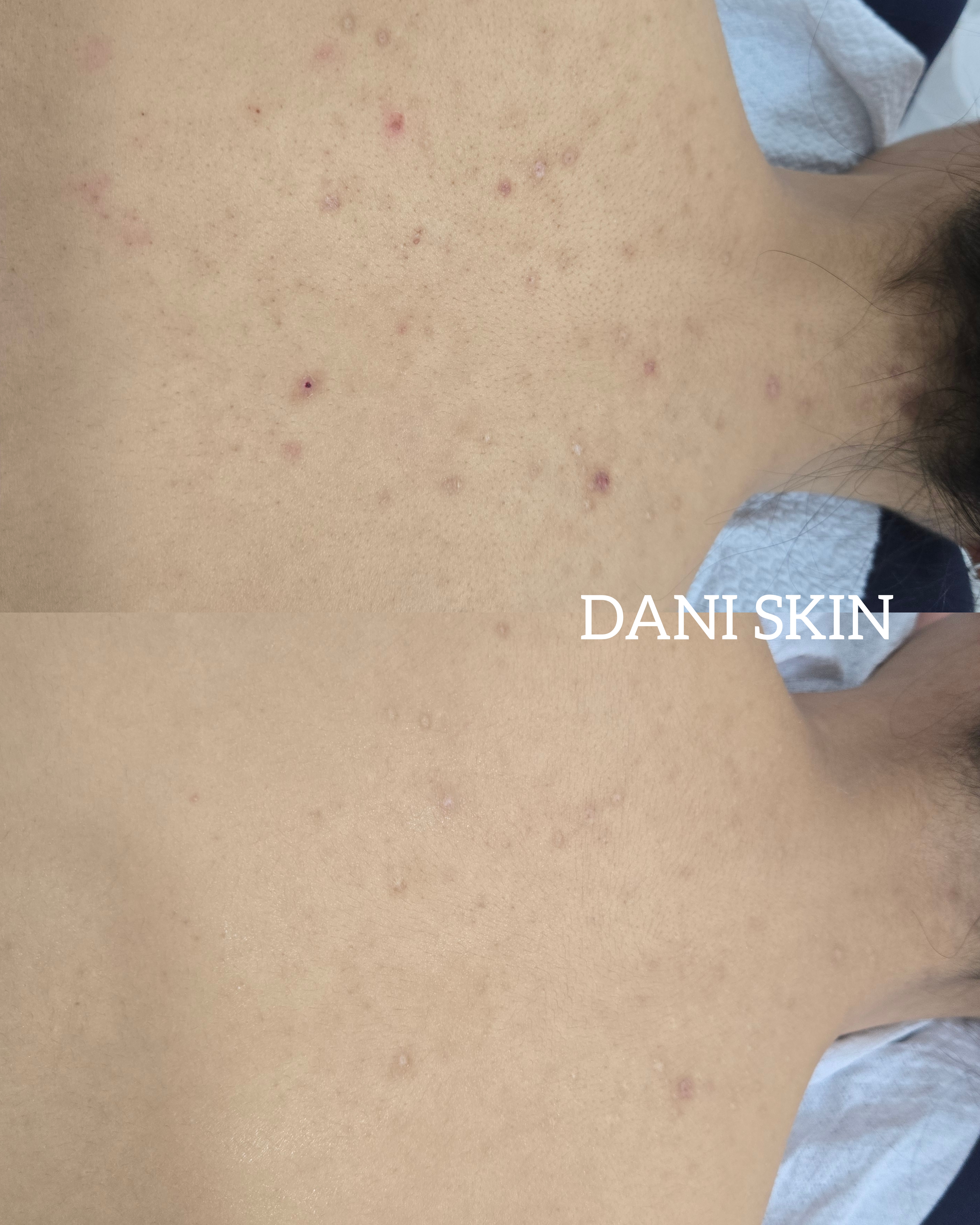 다니스킨 대표 이미지